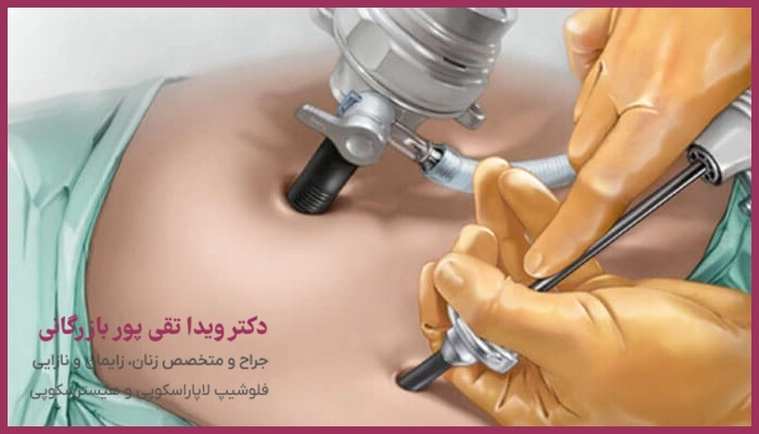 بهترین جراح لاپاراسکوپی رحم در مشهد