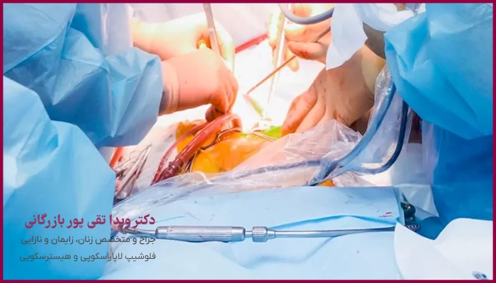 عوارض و خطرات احتمالی بعد از لاپاراسکوپی اندومتریوز