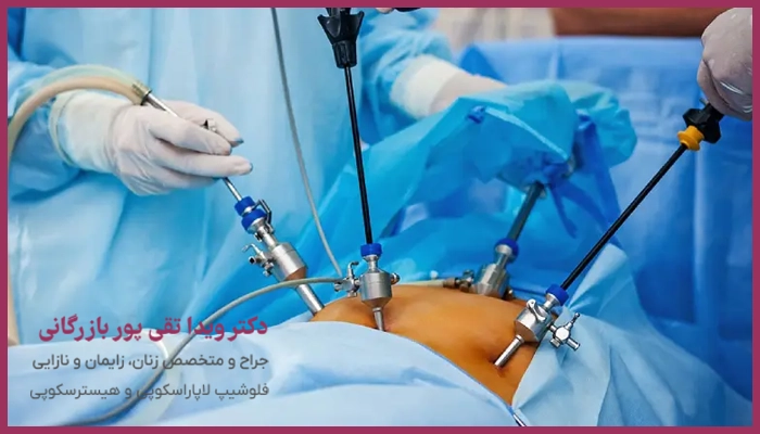 مراحل انجام لاپاراسکوپی رحم