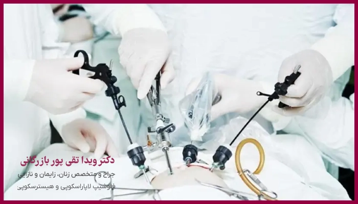 مراحل انجام لاپاراسکوپی فیبروم رحم