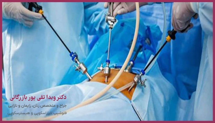 نکات مراقبتی بعد از لاپاراسکوپی کیست تخمدان
