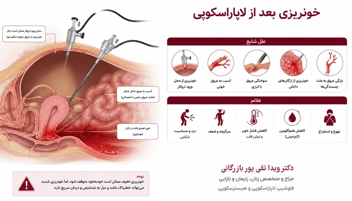 داشتن خونریزی بعد از لاپاراسکوپی طبیعی است؟