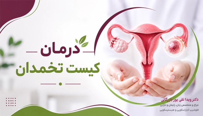 درمان کیست تخمدان