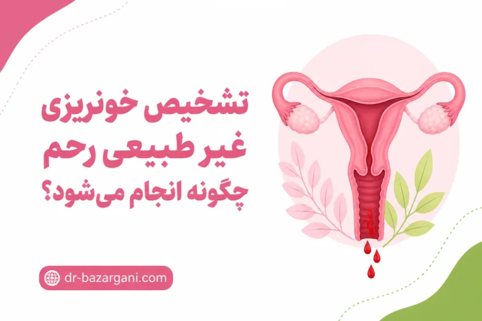 تشخیص خونریزی غیر طبیعی رحم چگونه انجام میشود؟