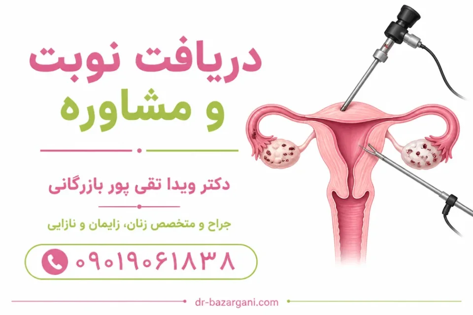 نمای توضیحی درباره لاپاراسکوپی برای بررسی ناباروری