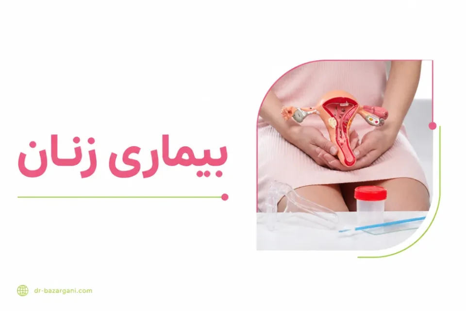 نمای توضیحی درباره معاینه لگنی و آزمایش ترشحات