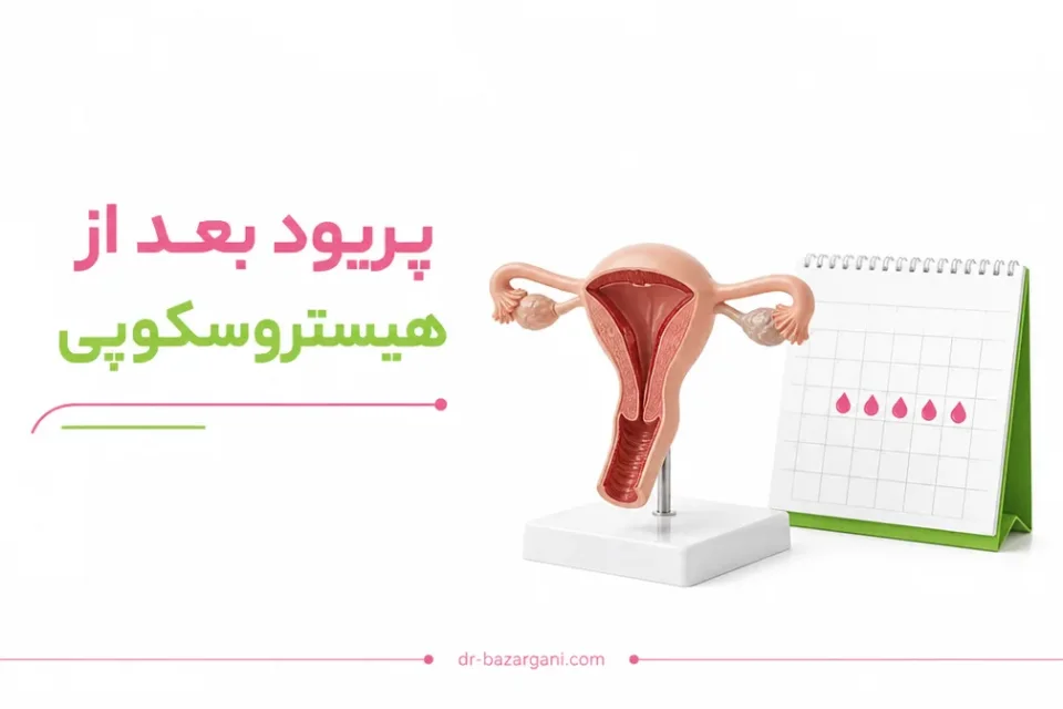تصویر آموزشی زمان بازگشت نخستین قاعدگی پس از هیستروسکوپی درمانی