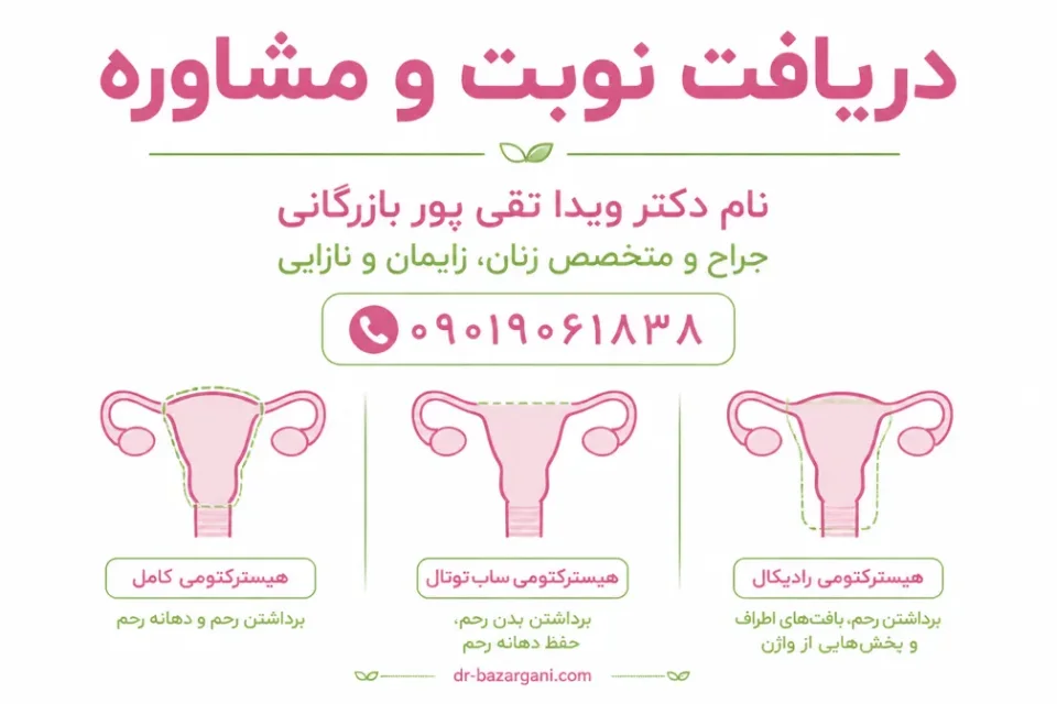 نمای توضیحی درباره هیسترکتومی رادیکال و برداشتن لوله یا تخمدان