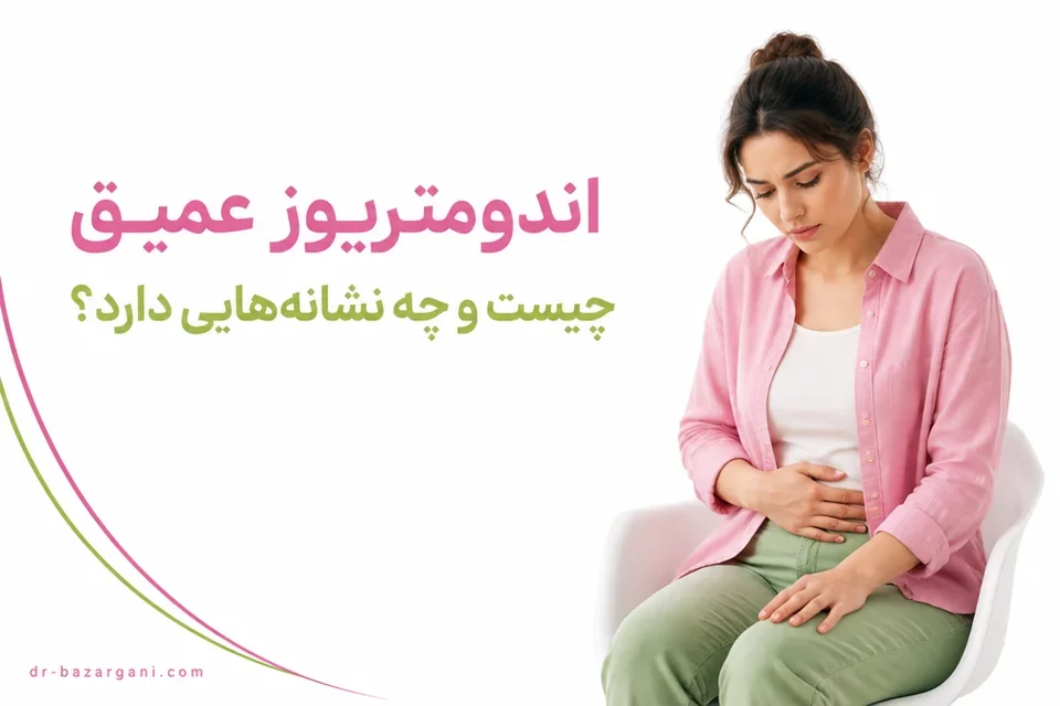 زن با درد لگنی و نشانههای اندومتریوز عمیق